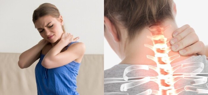 Đau cơ xơ hóa Khái niệm và Cách giảm triệu chứng 2